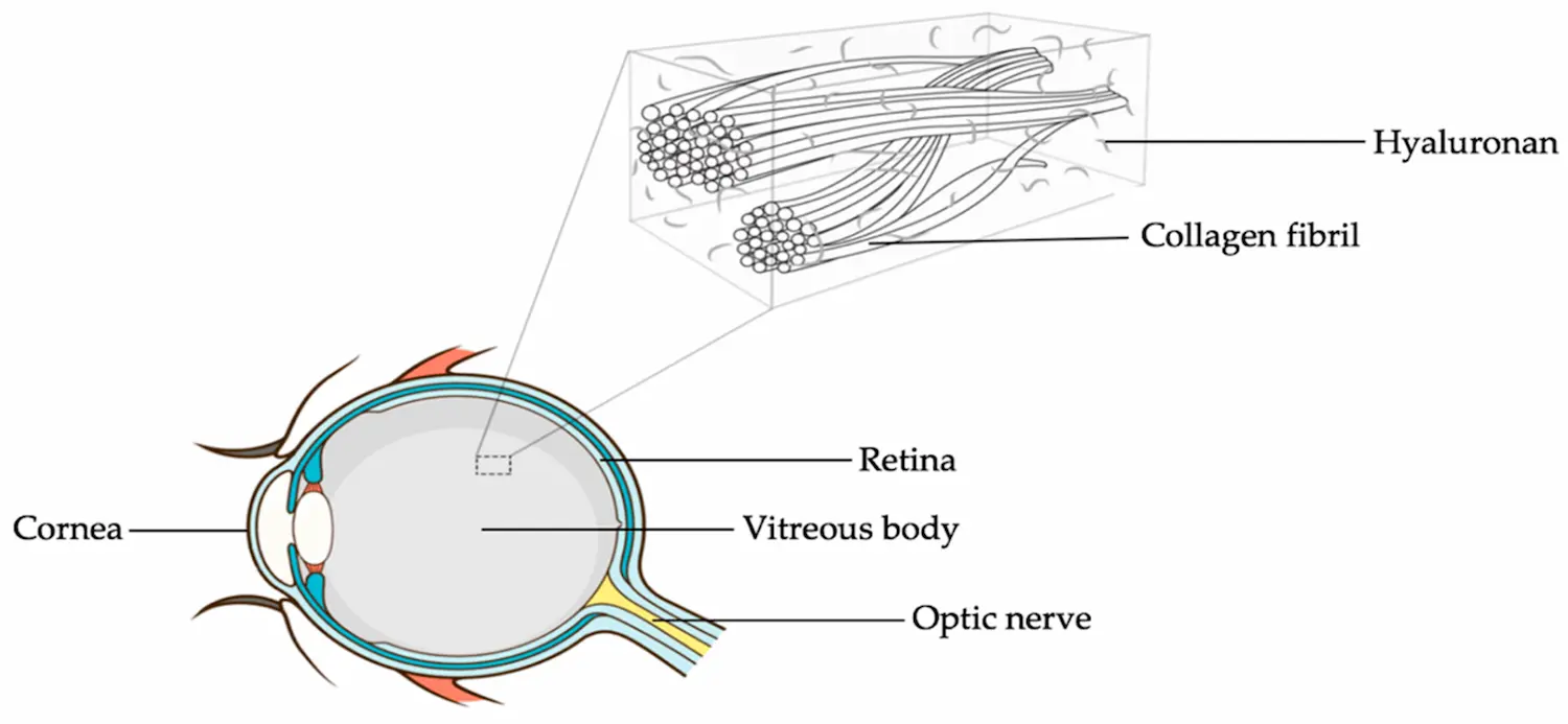 Illustration of vitreous fluid in the eye