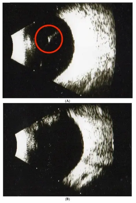Supporting eye health illustration