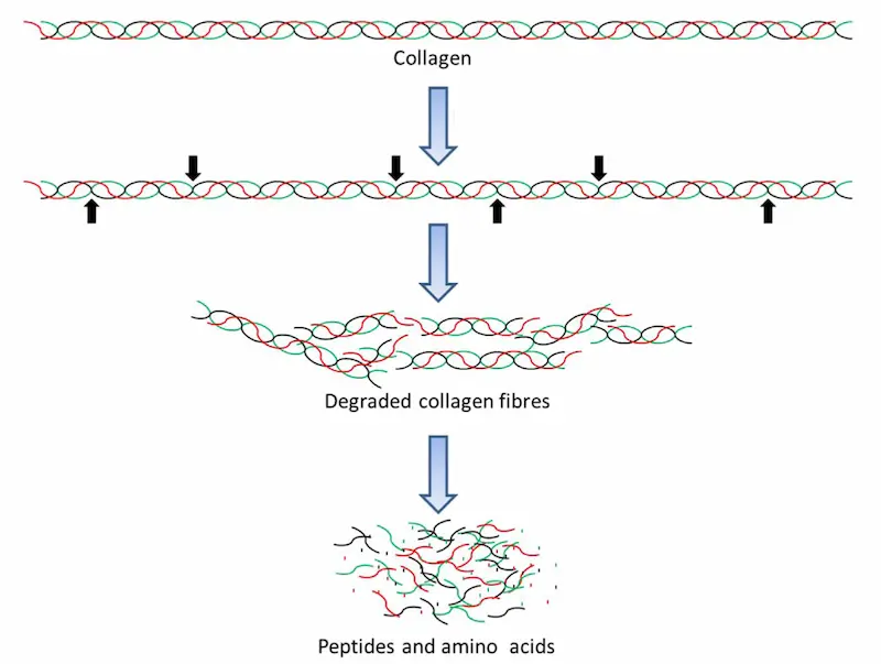 Illustration showing vitreous support